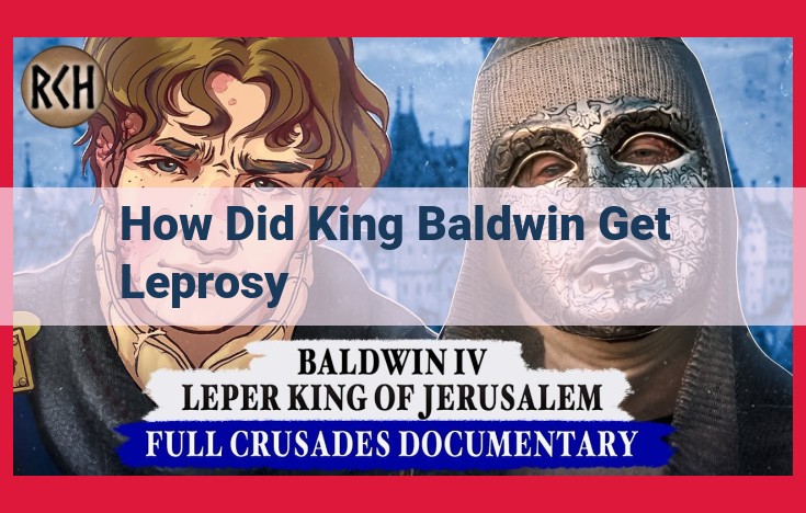 King Baldwin IV's Triumph over Leprosy: Pioneering Treatments and Christian Resolve in Medieval Jerusalem