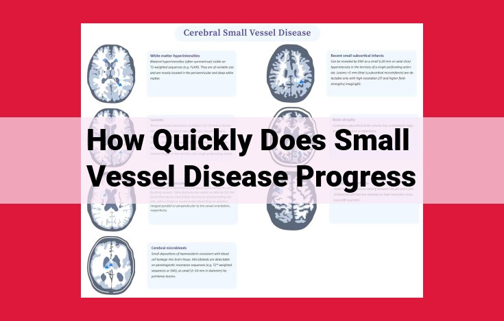 Understanding Small Vessel Disease Progression: Managing Risk Factors for Cognitive Health