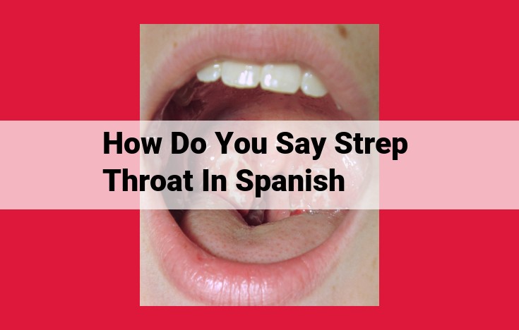 How to Say Strep Throat in Spanish: Angina Estrepcocócica