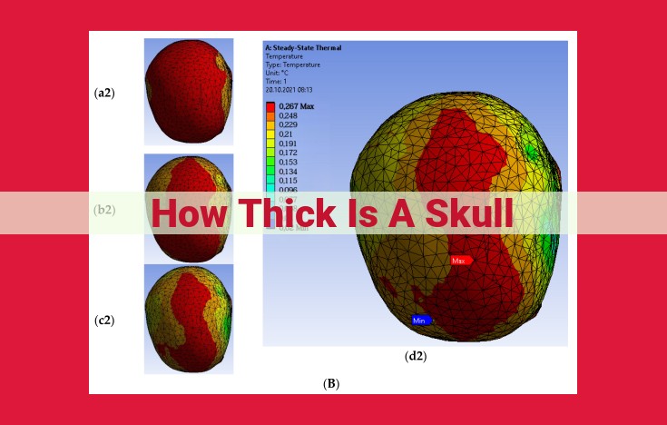 Variation in Skull Thickness and Its Impact on Protection and Vulnerability